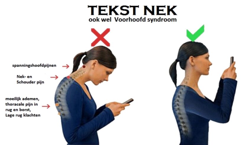 tekst nek of voorhoofd syndroom