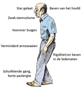 bewegingsstoornissen bij Parkinson